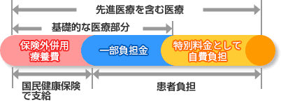 先進医療について